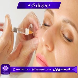 تزریق ژل گونه
