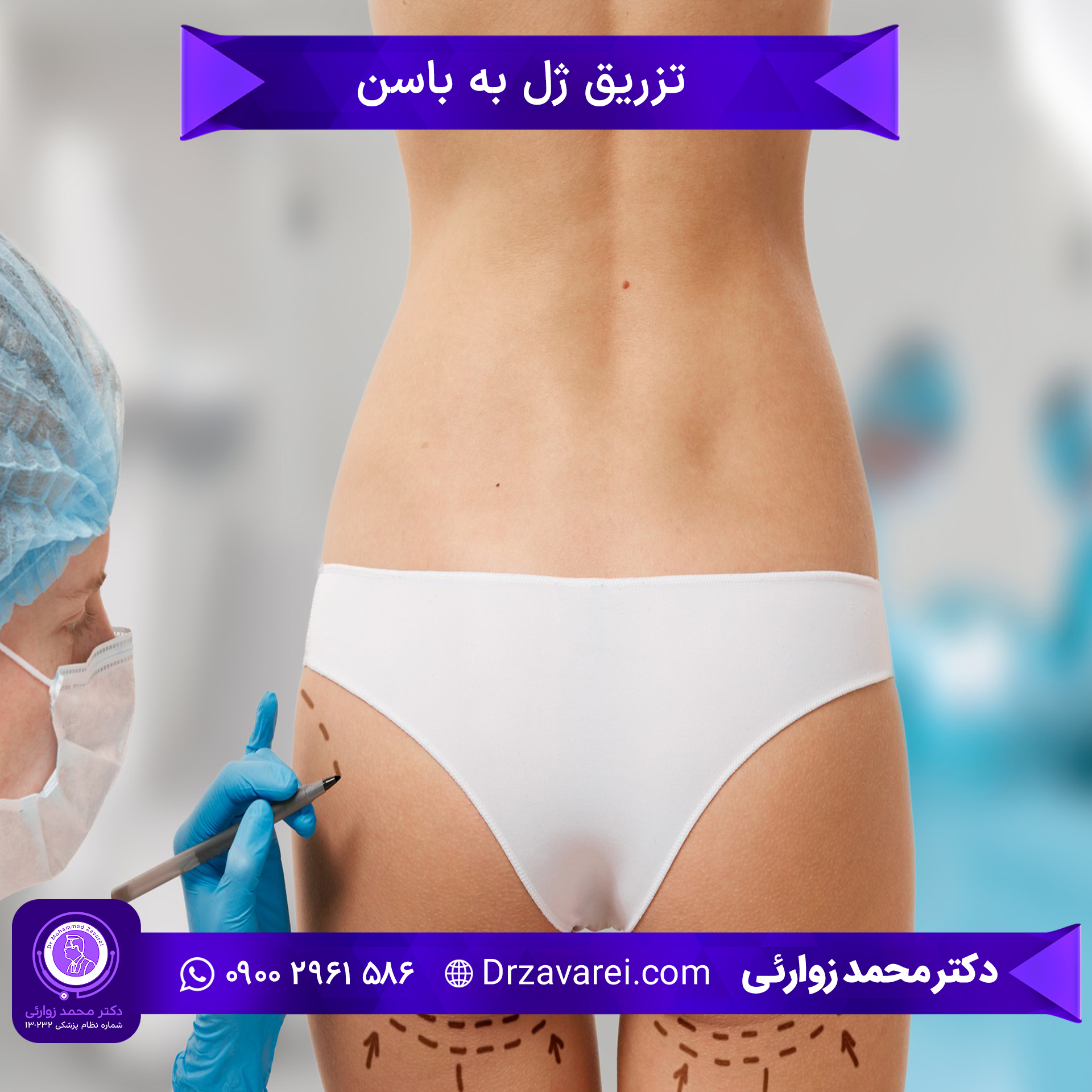Gel injection into the buttock تزریق ژل باسن